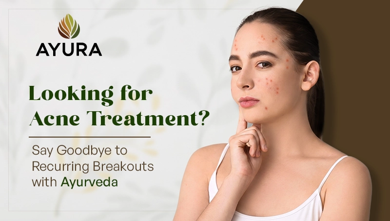 Acne Treatment Banner